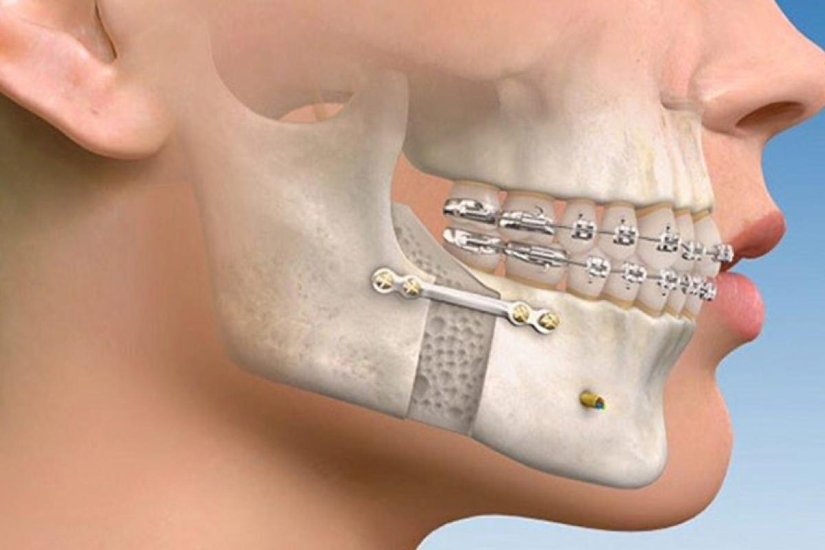 جراحة الوجه والفكين