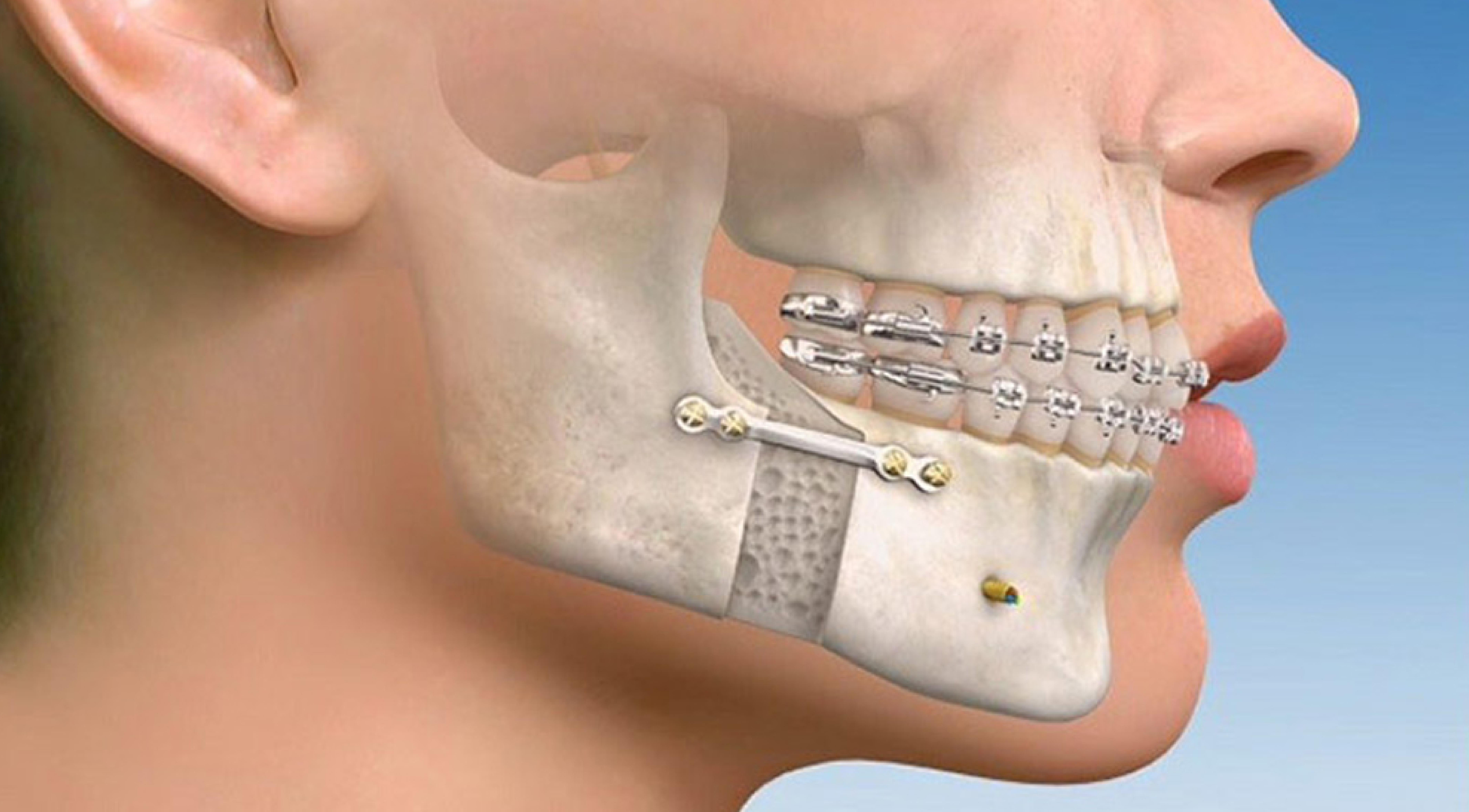 جراحة الوجه والفكين